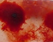 Blood Agate Healing